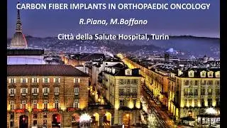 Carbon Fiber Implants in Orthopedic Oncology - Dr. Boffano - Vienna 2017 Final