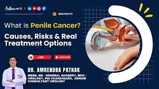 What is Penile Cancer? Causes, Risks & Real Treatment Options 💡 | By Dr. Amrendra Pathak #Urology