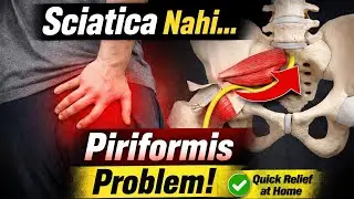 Piriformis Syndrome Treatment | Buttock Pain & Sciatic Nerve Relief with Exercises