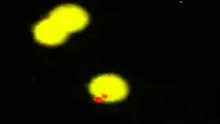 HEK293 with Constitutive YFP Transfected with ROX-labeled RNA, 10X