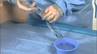 Medical Training on EVLT Procedure