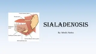 Sialadenosis - causes, pathophysiology