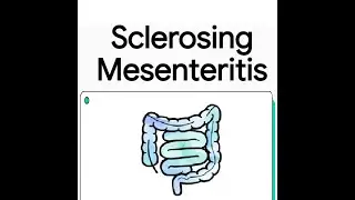Sclerosing Mesenteritis | A Rare Inflammatory Disorder Explained for Clinicians and Trainees