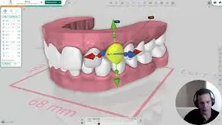 Новая полностью автоматическая сегментация в Titan Dental Design и взгляд в будущее