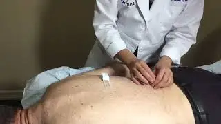 Gentle Acupuncture - Health & Hope Institute
