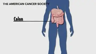 The benefits of a colonoscopy - Wear the Gown