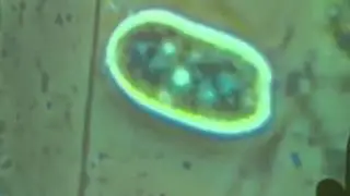 Hay Infusion Protozoan - General Microbiology, UW Stout - Professor Daytime, Cure Moderate Wounds