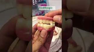 Fini jelly TEETH #youtubeshorts#viral#trending#food#youtube#shortvideo#foodmagic#jelly#teeth#candy