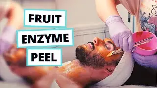 Fruit Enzyme Peel (THE PROCESS)