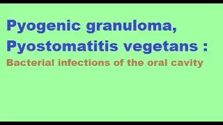 Pyogenic Granuloma, Pyostomatitis vegetans: Bacterial infections of the oral cavity