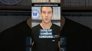 Loss of Lumbar Lordosis - Dallas spine surgeon #lumbarlordosis #spinesurgeon