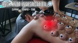 🔎 Investigating Back Knots | Voice Guided Deep Tissue Massage w/ Cupping, Heated Scraper & Tend