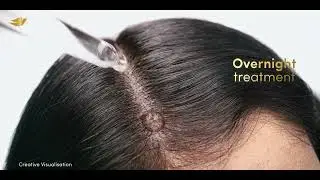 Density Boost In 8 Weeks | Dove Scalp + Hair Therapy Range