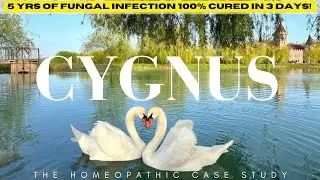 Cygnus Bewickii | Case Study Explained |HOMEOPATHY