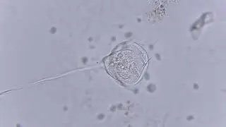 Vorticellidae