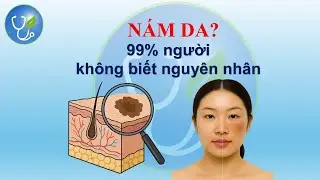 N&aacute;m xạm da - hiểu đ&uacute;ng để chữa thanh c&ocirc;ng  #Namda #noitietto #tuyenthuongthan #hethankinh