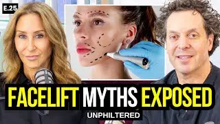The Truth About Facelifts No One Tells You | The UnPhiltered Podcast