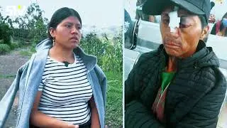Rafael Lanchimba, de la comunidad El Cercado, perdió su ojo izquierdo durante el paro en Imbabura.