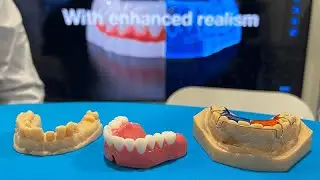 Dental World Ki&aacute;ll&iacute;t&aacute;s 2023 - Bemutatkozik az &uacute;j Stratasys TrueDent alapanyag