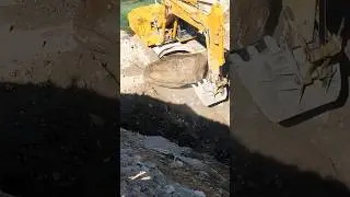 Huge Stone Removed #shortsfeed #trendingonshorts #shorts