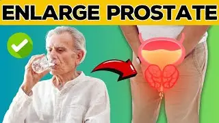 Top 5 Drinks Help Shrink an Enlarged Prostate  |  enlarged prostate treatment