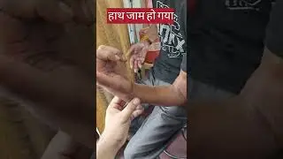 कलाई जाम after wrist fracture #jam #health #shorts #short #youtubeshorts #shortsfeed #shortsviral