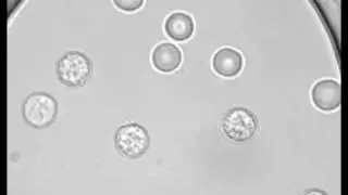 Osmotic burst of blood cells