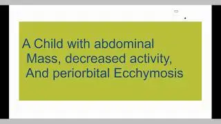 A child with Abdominal mass. A clinical case study - Pediatrics