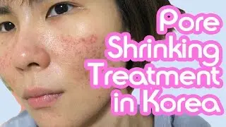 Shrinking my Pores in Korea! (Non-invasive skin treatment)