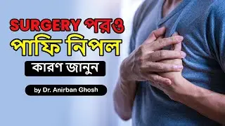 Gynecomastia Surgery in Kolkata | Best Man Boobs Treatment Explained