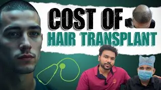 Cost of Hair transplant for Subscriber (BIG FUE)