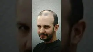 KEITH GORDON