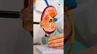 Top 7 spices to stop proteinuria quickly and heal kidney fast | #viral #shorts #shortvideo #kidney