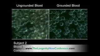 Effect of Grounding on Blood