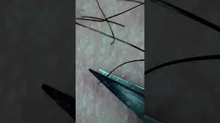 Tweeze & Pluck | 50x Zoom Close-up #1