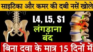 कमर की दबी नस घर पर खोलें | ExercisesFor Sciatica Pain Relief Exercises Back Pain Relief Exercises