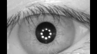 IrIs Recognition Matlab Source Code