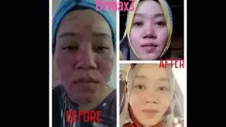 Firmax NCR Cities Testimonies of Magic Cream, Miracle Cream ( King Group OFFICE )