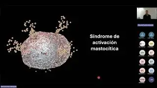Una sorpresa positiva tras el trasplante de médula ósea en una paciente con lupus refractario.