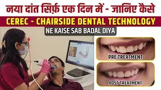 नया दांत सिर्फ एक दिन में - जानिए कैसे CEREC ने कैसे सब बदल दिया  | CEREC Technology kya hai?​