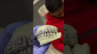 Trapboyfreddy gets new chrome heart diamond grill #dallas #texas #fyp