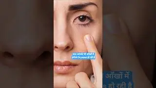 Best Eye Drop || Opthacare eye drop||Eye Drop for Dry eyes and Redness of eyes #eyedrop #healthyeyes