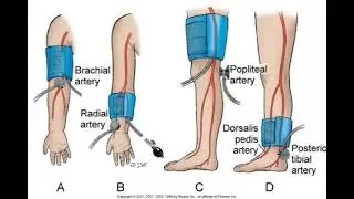 Types of Blood pressure and pulses point..