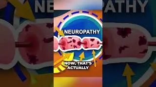 1~Stop Neuropathy In Its Tracks: The Role of Homocysteine in Nerve Damage