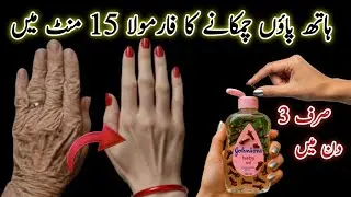 Homemade Winter Special Hands And Feet Whitening Serum | Hand Feet Remedy for Instant Glow at Home 