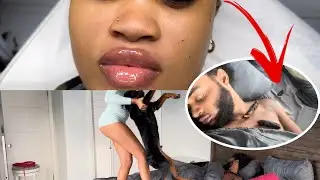 Getting My Lips Done 💋*Dog 💩Prank On My Boyfriend*