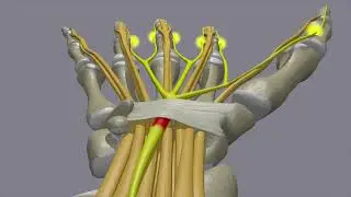 Carpal tunnel syndrome#3d #3danimation #3danimationtutorial #orthopaedicsurgeon #arthroscopicsurgery