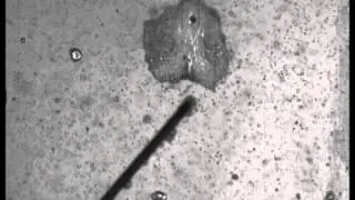 Bubble dynamics in bubbly medium