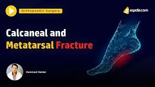 Calcaneal and Metatarsal Fracture | Orthopedic Surgery | V-Learning | Trailer