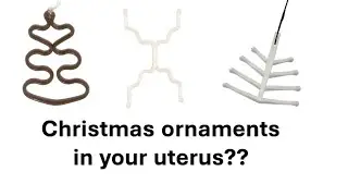 IUDs over the years (from Museum of Contraception and Abortion)